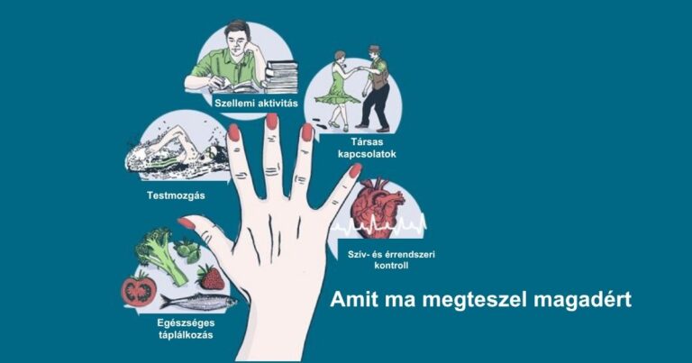 fingers modell